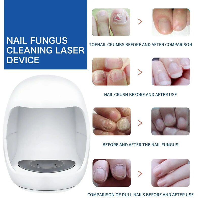 Fungal Nail Laser Device Repair Fast  Nails Fungus Onychomycosis