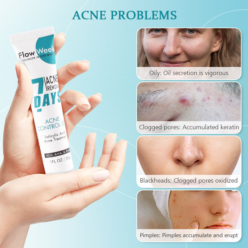 Flow week Salicylic Acid Acne Treatment Gel Tea Tree Pimple Spots Removal Face Cream Anti-Acne Whitening Cream Skin Care