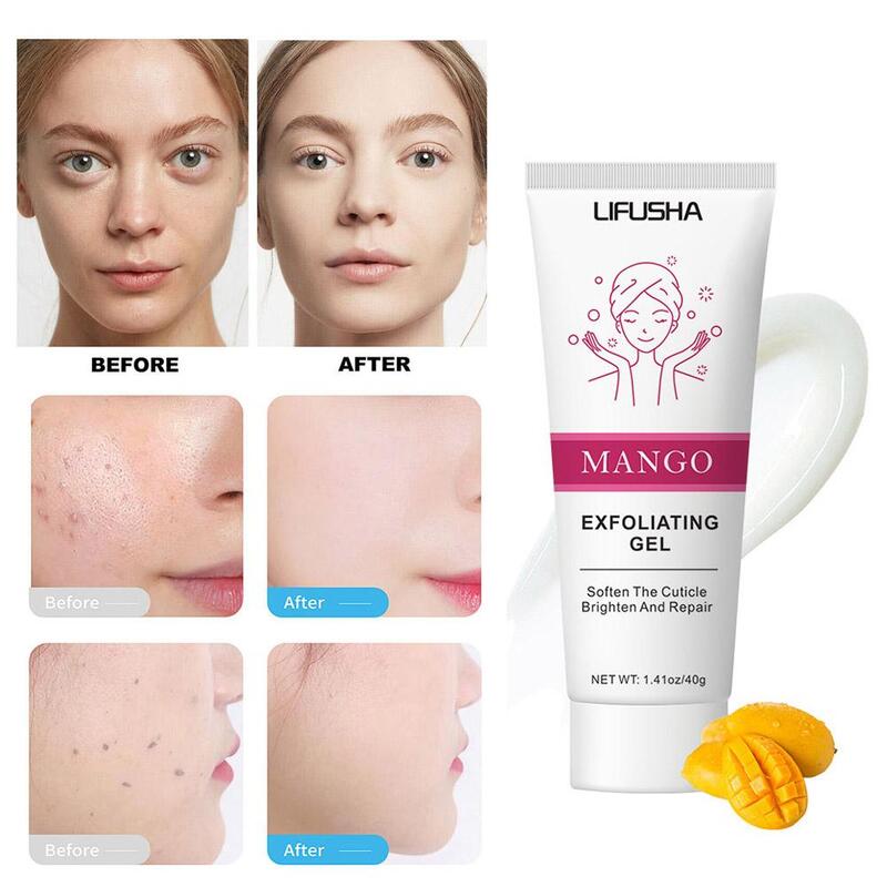 Mango Peeling Gel Creme Gesichts peeling Peeling Haut aufhellen Feuchtigkeit creme Reiniger Reparatur White ning Peeling erweichen p8d1
