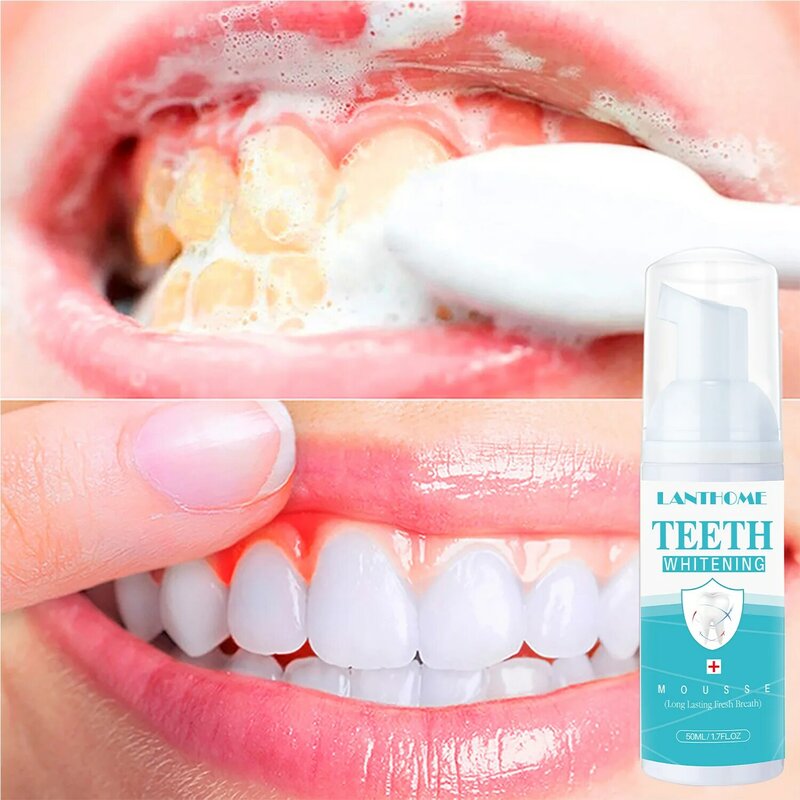 Original Lanthome Dentes Profissionais Whitening Booster Mousse 50ml Tooth Stain Remoção Creme dental Limpeza Espuma Reparos Gengivas