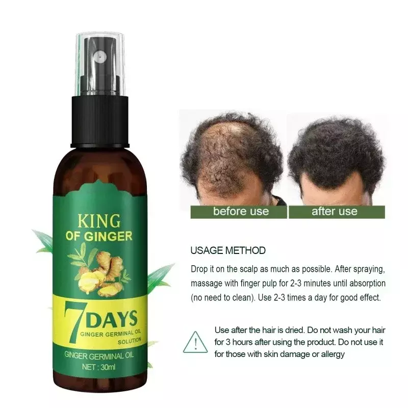 Ginger Hair Growth Spray Massage Scalp Strengthening Dense-Hair Preventing Hair Loss Strengthening-Hair Repair Nourishing Liquid