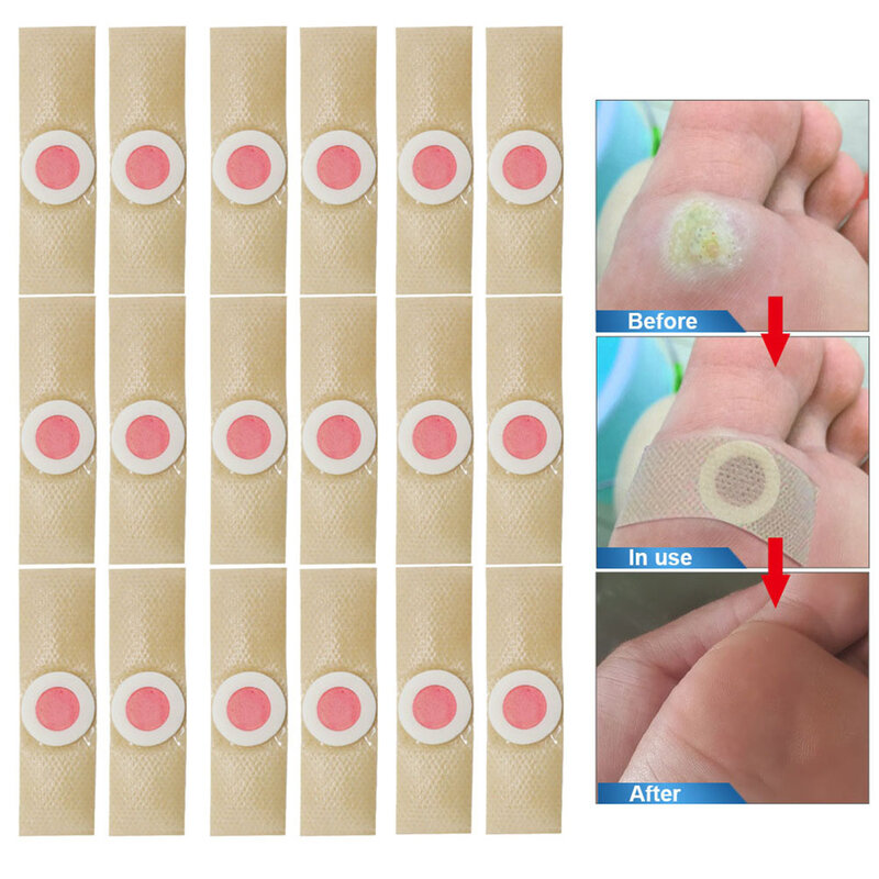 Corn Pad Remover Callus Cushion Pads Cushions Foot Toe Adhesive Feet Removers Salicylic Corns Fast Step Finger Treatment Acid