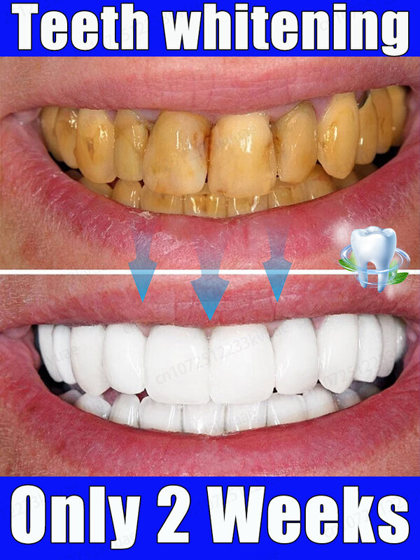 Pasta de dente branqueadora, limpa o hálito, remove manchas e tártaro