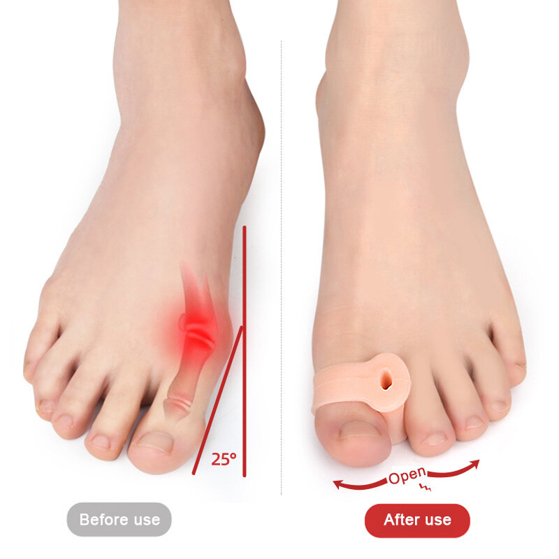 2 Pcs Gel Toe Separator Hallux Valgus Bunion Corrector Straightener Soft Silicone Toe Protector Spacer Foot Care Tool