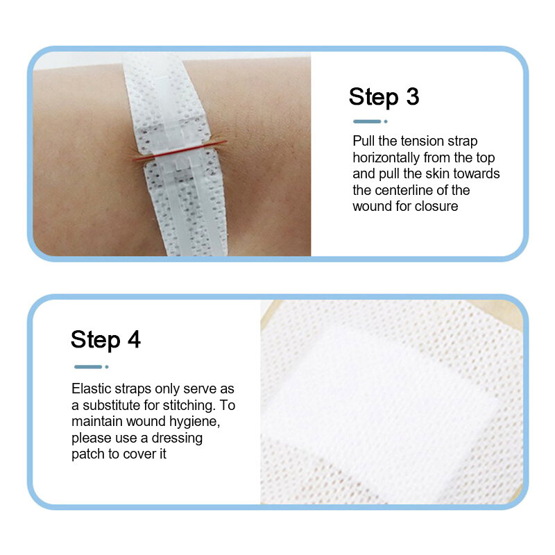 1 Pc Zipper Tie Wound Closure Patch Zipper Band-Aid Wound Fast Suture Outdoor Portable Hemostatic Patch First Aid Tool
