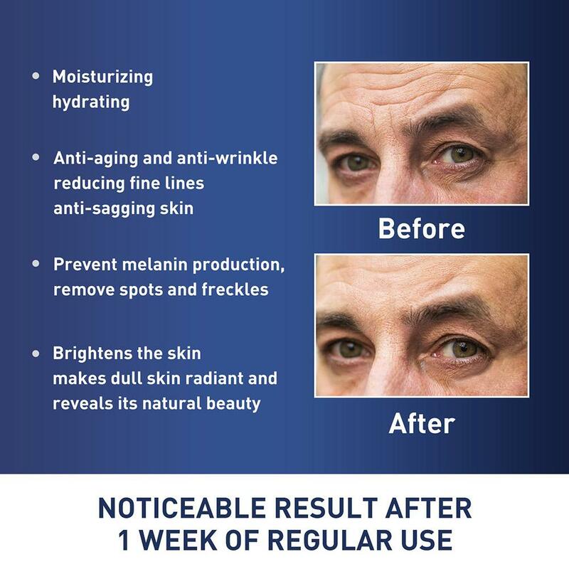 Anti-rugas creme facial para homens, colágeno, remover linhas finas, firmar, levantamento, anti-idade, hidratar, nicotinamida, clarear, iluminar, oftalmologista