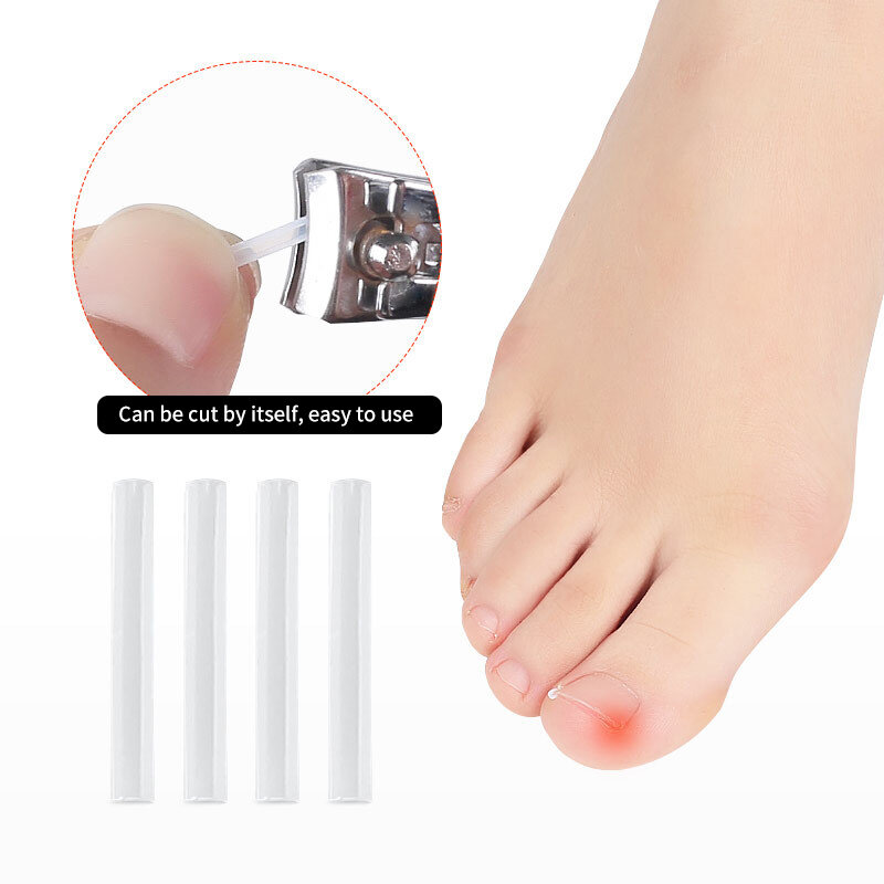 50 Stück ein gewachsenes Zehen nagel korrektur werkzeug ein gewachsene Zehen nagel behandlung elastischer Patch aufkleber Glättung sclip Klammer Pediküre-Werkzeug