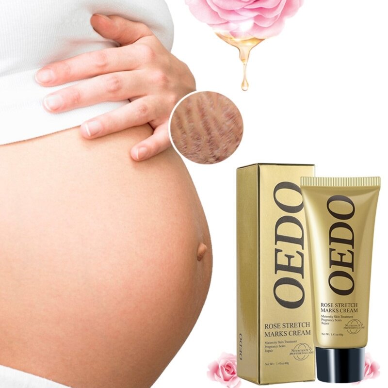 Zwangerschap Litteken Verwijdering Crème Zwangere Vrouw Pigmenten Correctie Reparatie Lichaam Verstevigende en Verhelderende