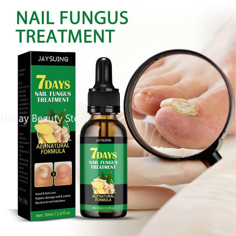 Solución para el cuidado de las uñas de los pies, tratamiento Funguss, aceite de paroniquia encarnado, esencia reparadora de uñas hecha con jengibre