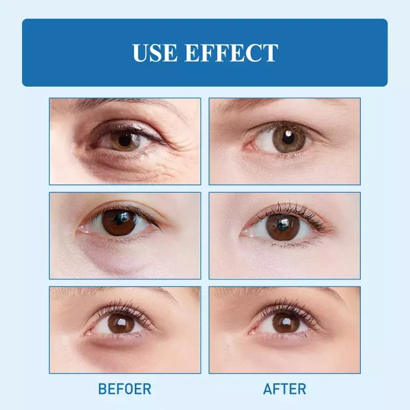 Veneno de cobra Peptide Eye Cream, hidratante, firmador, remover bolsas oculares, círculos escuros, inchaço, anti rugas, reparo noturno