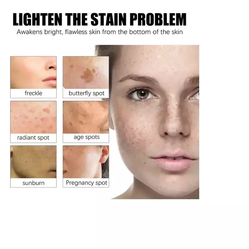 Skuteczne wybielanie krem do twarzy plam usuwa ciemna plama antypigmentacja Melasma poprawia matowość rozjaśnia pielęgnacji skóry twarzy krem