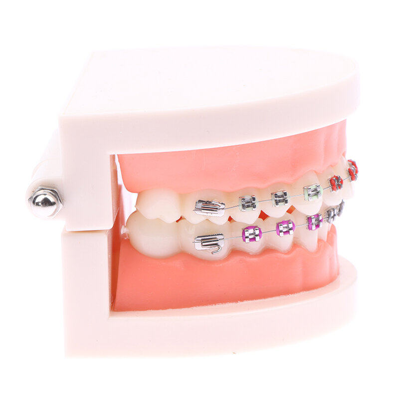 Tandheelkundig Orthodontisch Model Tandheelkundig Model Tandheelkunde Orthodontische Tanden Model Met Haakjes Voor Tandarts Studie Patiënt Demo