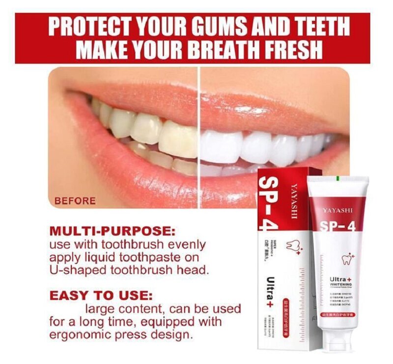 Pasta de dente probiótico SP-4, clareamento, clareamento, respiração fresca, boca, limpeza dos dentes, saúde, cuidados dentários, 120g