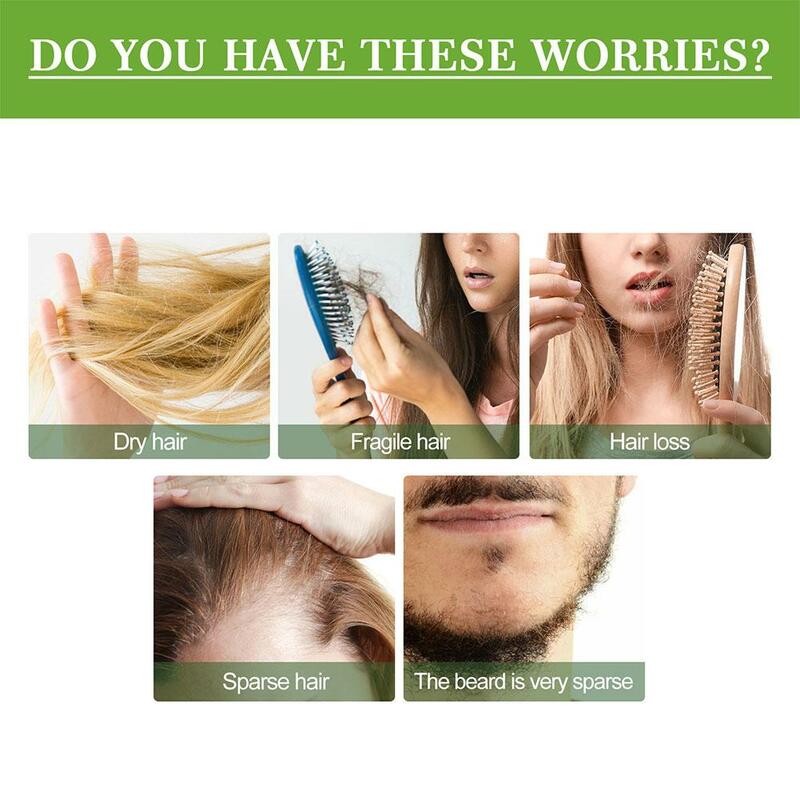 Minyak esensial Rosemary perawatan kulit kepala mencegah rambut rontok anti-keriting memperkuat nutrisi perbaikan perawatan rambut halus