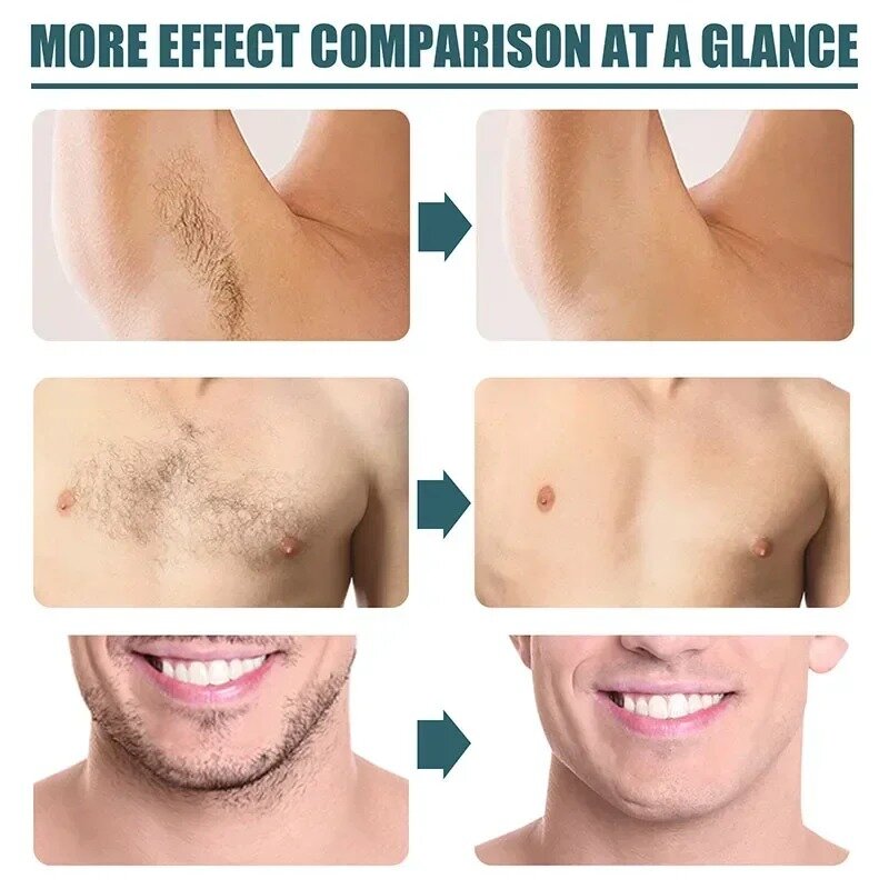 Creme removedor de cabelo indolor para homens, crescimento do cabelo, eliminar a barba, axila, peito, partes privadas, creme depilatório