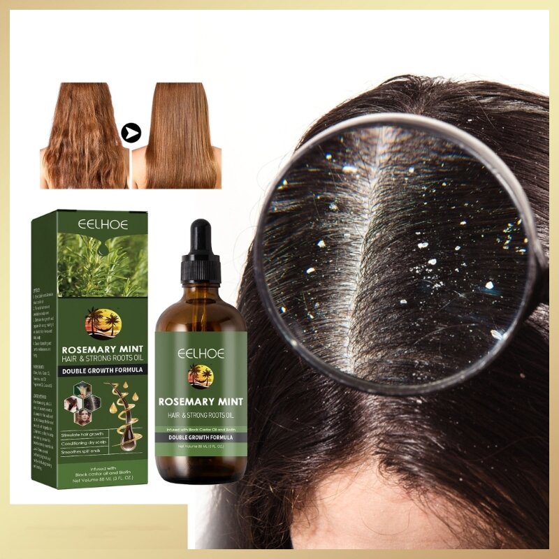 Rosemary Mint Scalp Hair Strengthening Oil Growing Hair Growing Essence Split End Care Anti Loss Hair Growth Drop Shipping