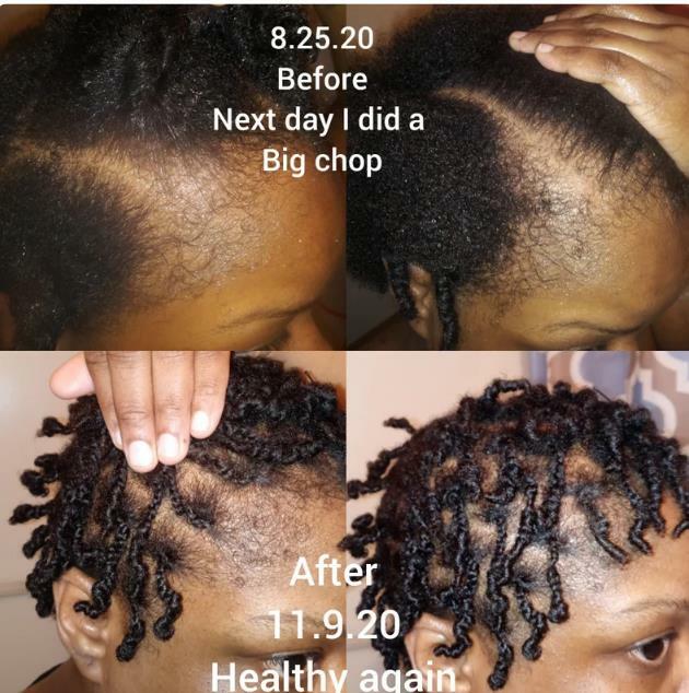 Óleo do rejuvenescimento do cabelo para o cuidado do cabelo, restauração do cabelo, produtos naturais do cabelo, produtos de cabelo com 20 óleos e ervas