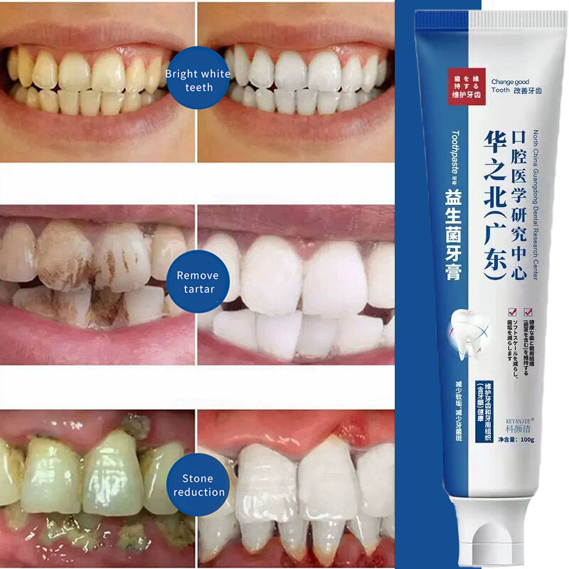 Sdotter-ホワイトニング歯のホワイトニングソリューション,歯のホワイトニング軟膏,ビタミンの除去,2023,新しいコレクション