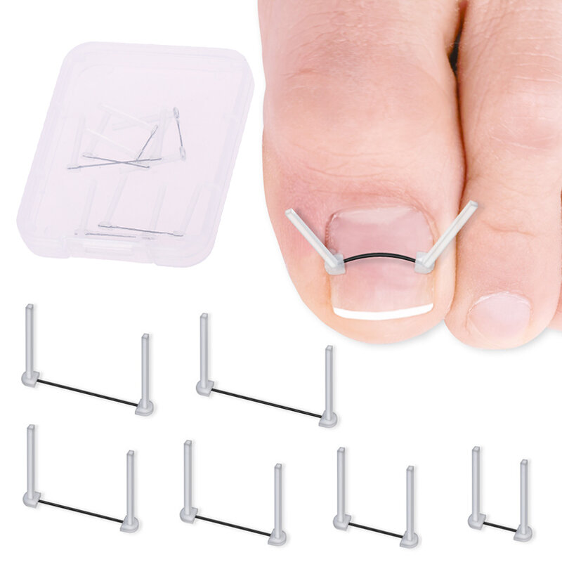 Ingrown Toenail Correction Wire Foot Care Tools Professional Treatment Recover Embed Toe Nail Pedicure Straightening Toe Tools