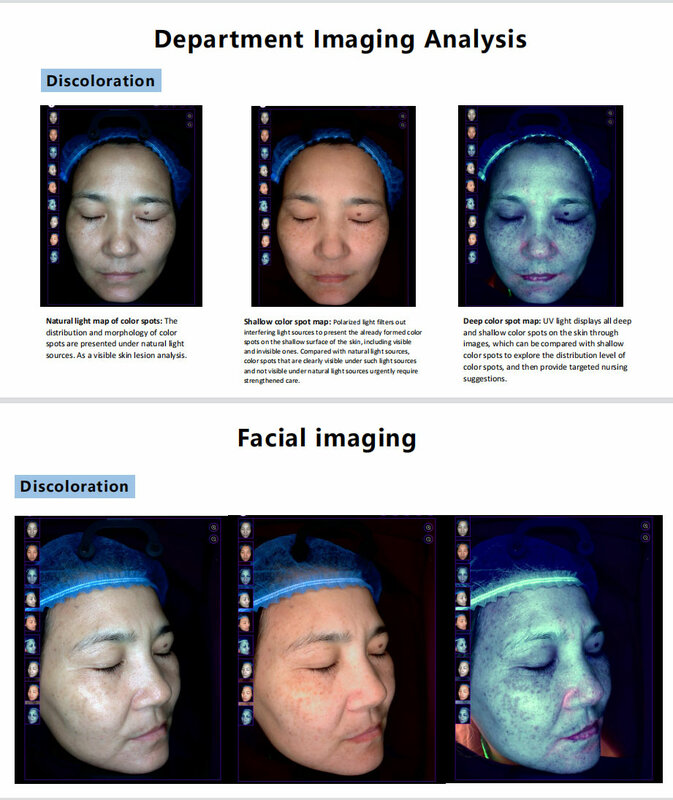 2024 트렌드 디지털 피부 스캐너 3D 분석기, 휴대용 피부 분석 기계, 얼굴 피부 3D 스캐너, 아이패드