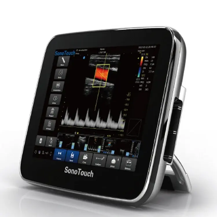 أجهزة الموجات فوق الصوتية الطبية المحمولة ثلاثية الأبعاد ، الأدوات المحمولة ل SonoTouch 30