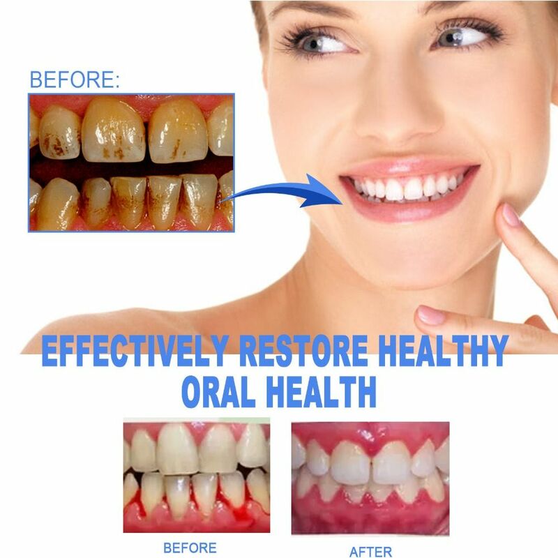 Cura orale Gel per il trattamento delle gengive riparazione dentale riduce il disagio Gum Shield Therapy Gel riduce l'infiammazione facile da usare
