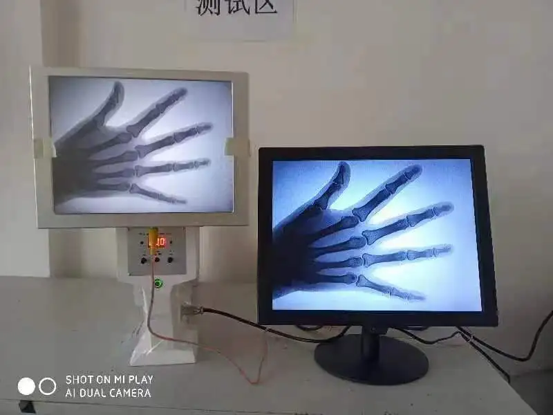 Portátil X-Ray Machine, Usado em Pet Bones, Diagnóstico, Diagnóstico, Clínica