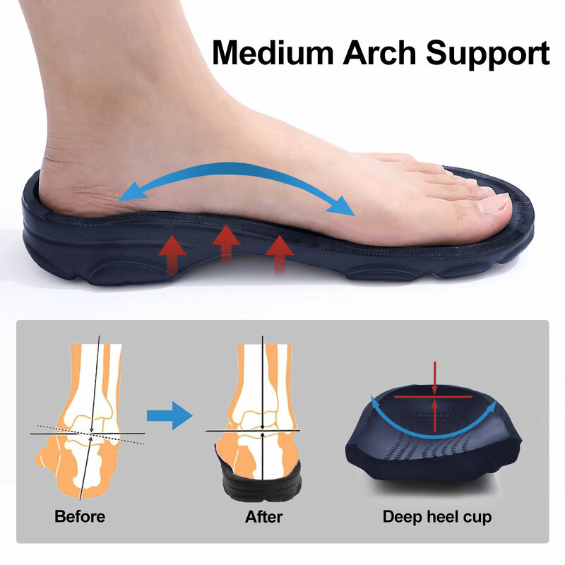Kidmi-zuecos de verano para hombre, zapatillas de playa transpirables para exteriores, suaves, sandalias de jardín para el hogar