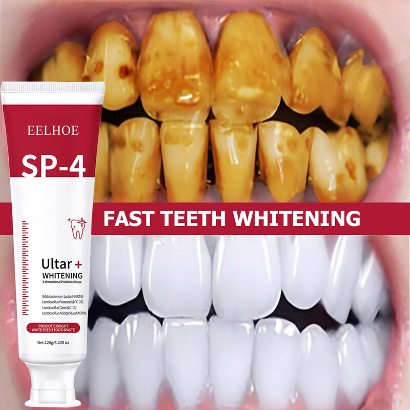 Dentifricio probiotico per carie SP 4 sbiancante pasta per la riparazione della carie detergente per denti rimozione della placca alito fresco cura dentale 120g