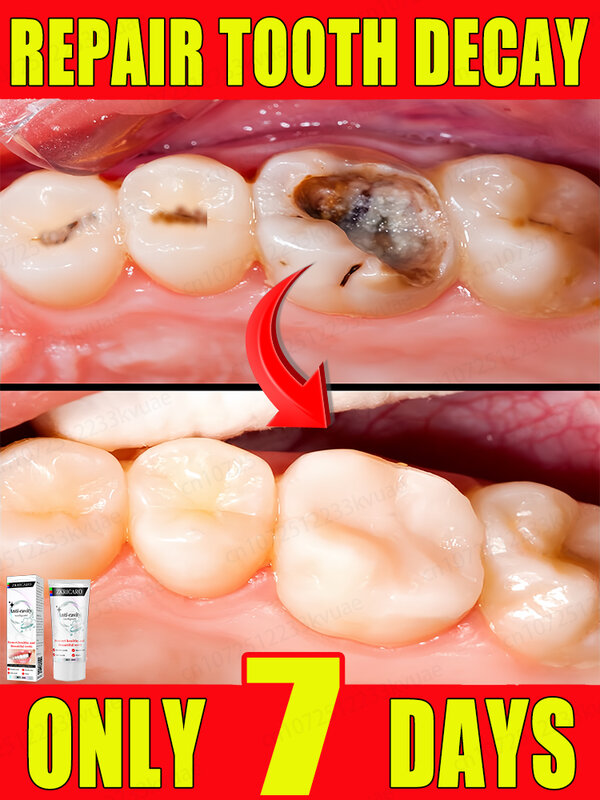 Repare a cárie dentária, remova a placa bacteriana e a periodontite. Branquear os dentes e eliminar o mau hálito