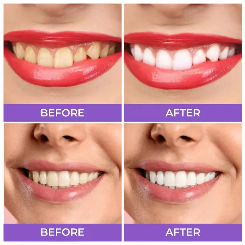 V34 Mousse Tandpasta Tanden Reinigen Helderder Whitening Tandpasta Gele Tanden Verwijderen Tandvlek Mondreinigingsproduct