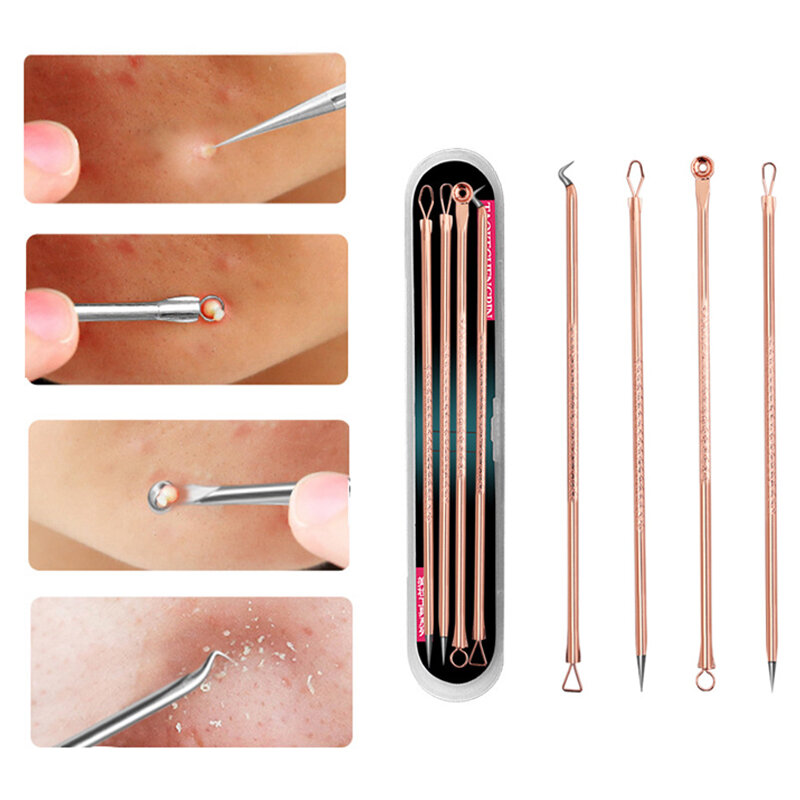 Removedor de espinillas y acné para mujer, dispositivo de belleza para el cuidado de la piel, limpiador de poros, gancho de aguja, 4 piezas
