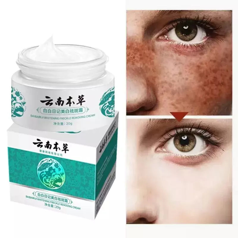 Melasma Cream Pekas Remover Original Collagen Pekas Freckles Remover Freckle Skin Whitening Cream