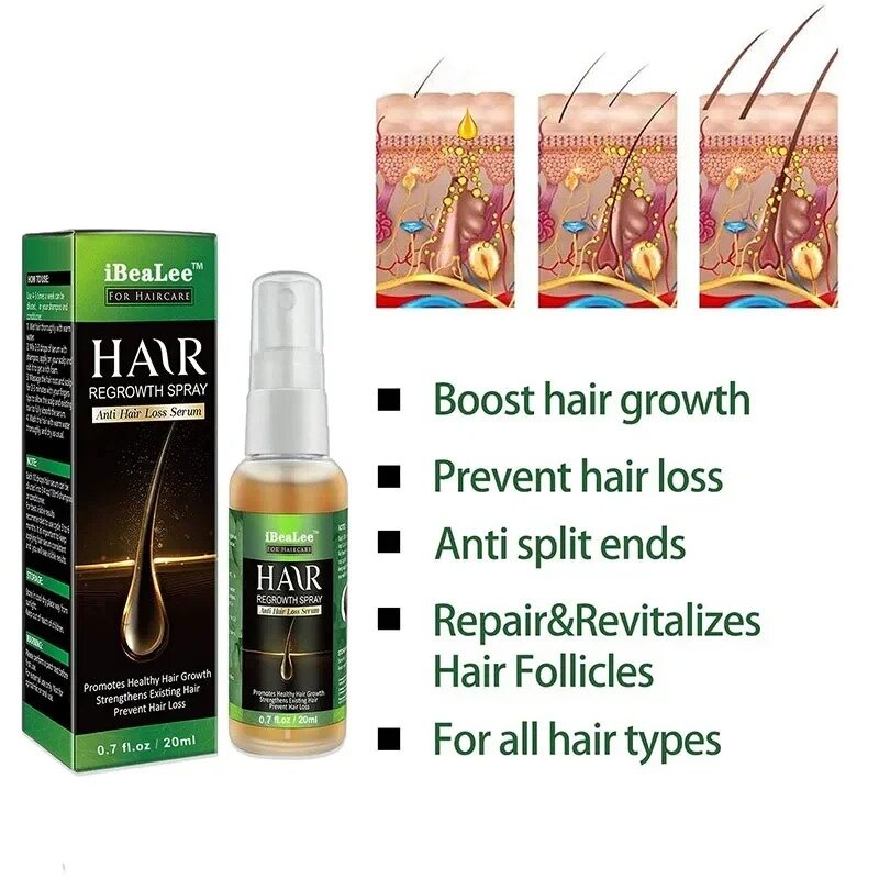 Spray per la crescita dei capelli allo zenzero naturale siero Anti perdita di capelli radici dei capelli crescita rapida trattamento danneggiato del cuoio capelluto liquido riparazione salute di bellezza