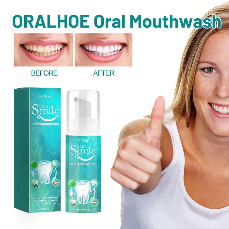 Mousse detergente per denti rimuovi macchie di placca respiro riparazione dentale dentifricio carie schiuma rinfresca sbiancamento orale gengivale Hyg L8H6