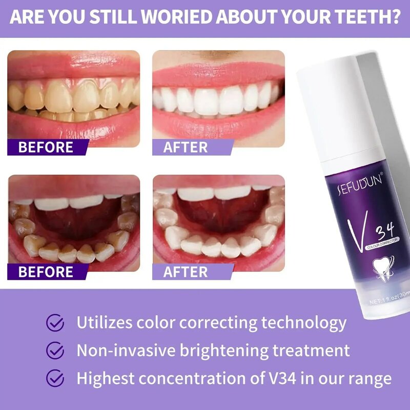 Фиолетовая отбеливающая зубная паста V34 smileEASE, удаление пятен, уменьшение желтения, уход за зубами, деснами, свежее дыхание, осветление зубов, 30 мл