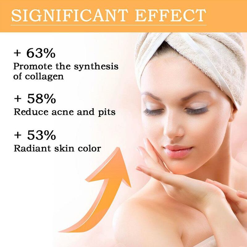 Brightening Skin Toning Toner, Remover Acne, Desvanecer-se Acne, Melhorar A Pele, Skincare, Hidratante, Clareamento Essência, G9t7