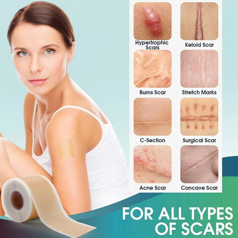 1Roll Silicone Scars Sheets Keloid Bump Removal Strips,Scars Reducing Treatments Surgical Scars, Burn,Tummy Tucks, C-Section
