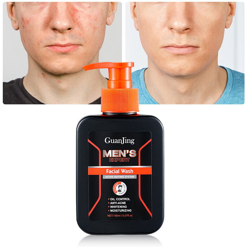 Heren Gezichtsreiniger Diep Reinigende Olie Controle Reiniger Whitening Anti-Acne Huid Hydraterende Gezicht Huidverzorgingsproduct Voor Mannen