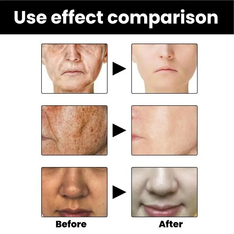 Serum korektor wajah, memperbaiki Melanin, penghilang bintik hitam, Serum perbaikan pelembab, Serum Vitamin C asam hialuronat
