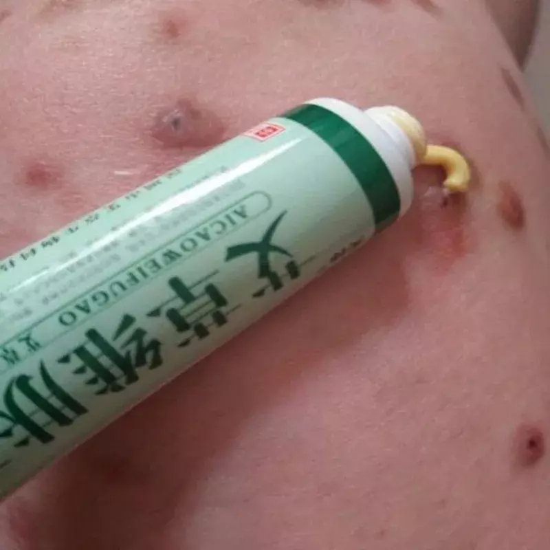 Krim salep untuk bayi, tanaman Wormwood kuat Psoriasis Dermatitis Eczema Pruritus salep krim perawatan kulit bayi tersedia 15g
