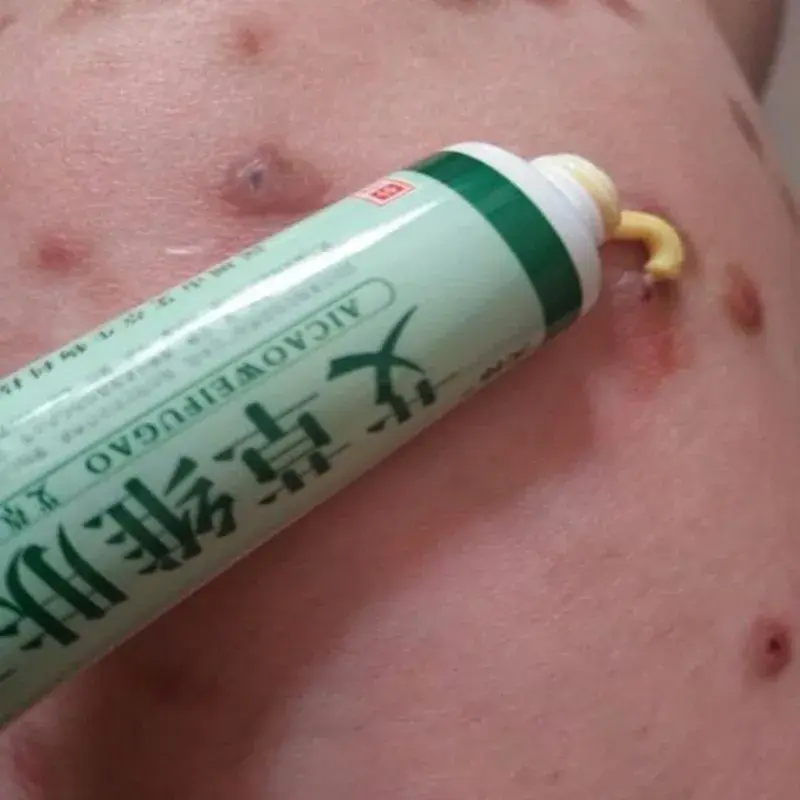 2 pezzi pianta di assenzio potente psoriasi dermatite Eczema prurito unguento crema cura della pelle bambino disponibile