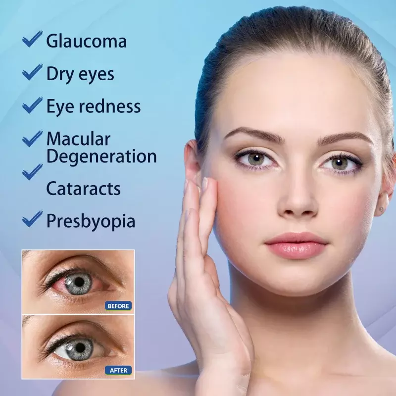 Eye Drop para melhorar a proteção da visão, aliviar a fadiga ocular, coceira seca, vermelhidão, visão loira, desconforto, solução de cuidado hidratante