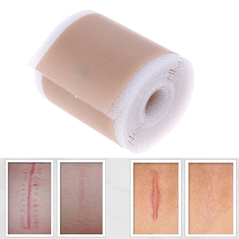 Scar Remoção Silicone Gel Folha, eficiente Cirurgia Bandage Tape, 4x150cm