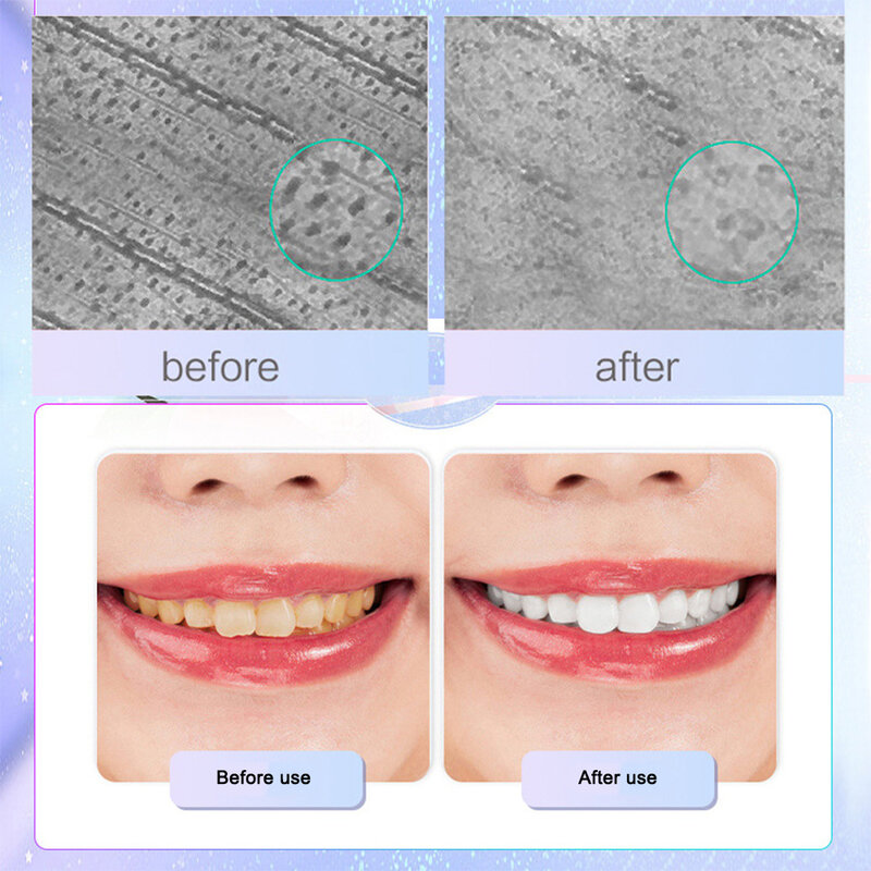 Sdotter-pasta de dientes blanqueadora con nicotinamida, higiene bucal, elimina eficazmente las manchas de respiración, cuidado Dental amarillo