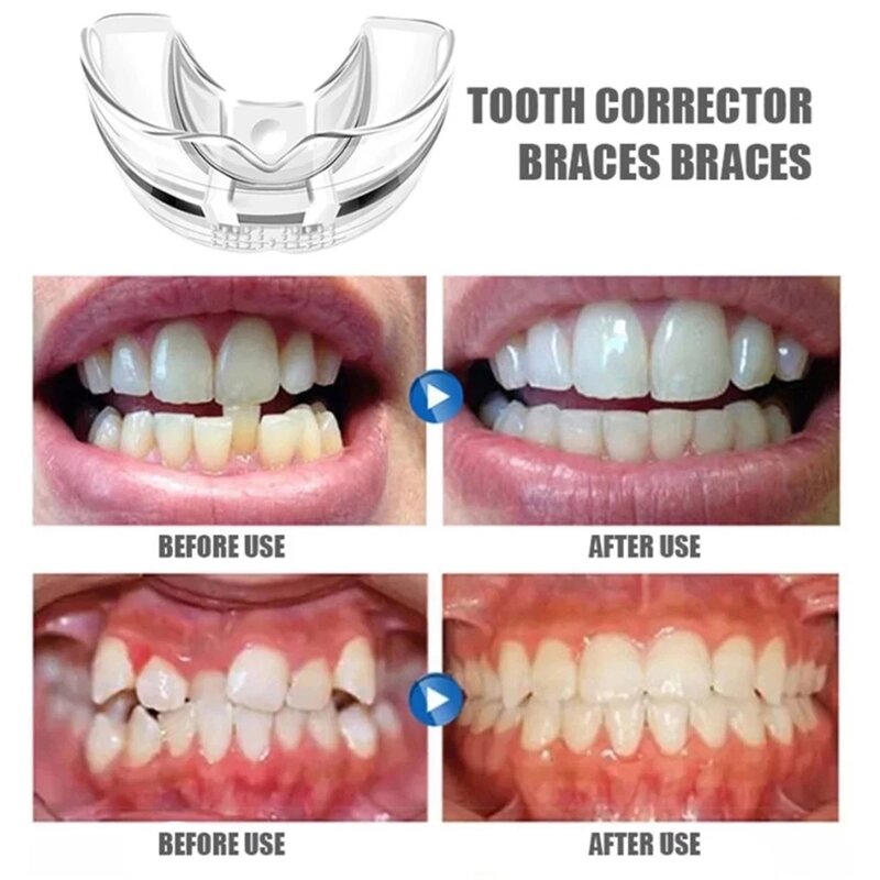 Corrector Dental de ortodoncia para adultos, retenedor de silicona, herramientas para enderezar los dientes, tapado, herramientas para el cuidado de los dientes, 3 fases