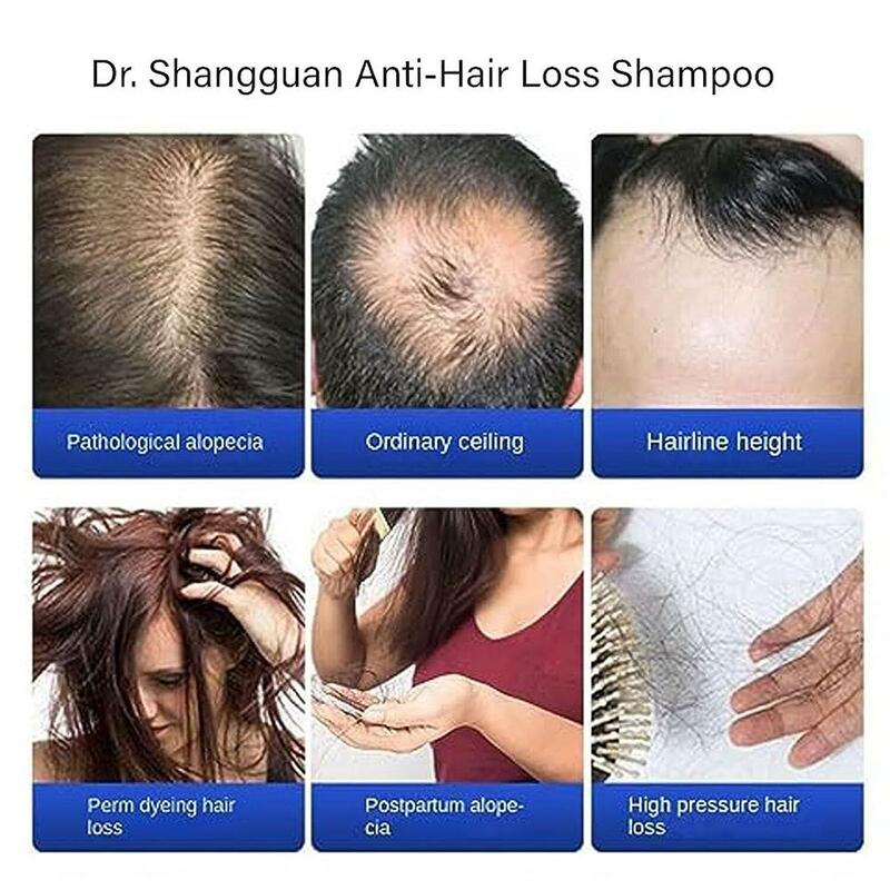 الشامبو المضاد لتساقط الشعر ، علاج الشعر ، سماكة الشعر ، H6J1 ، EW
