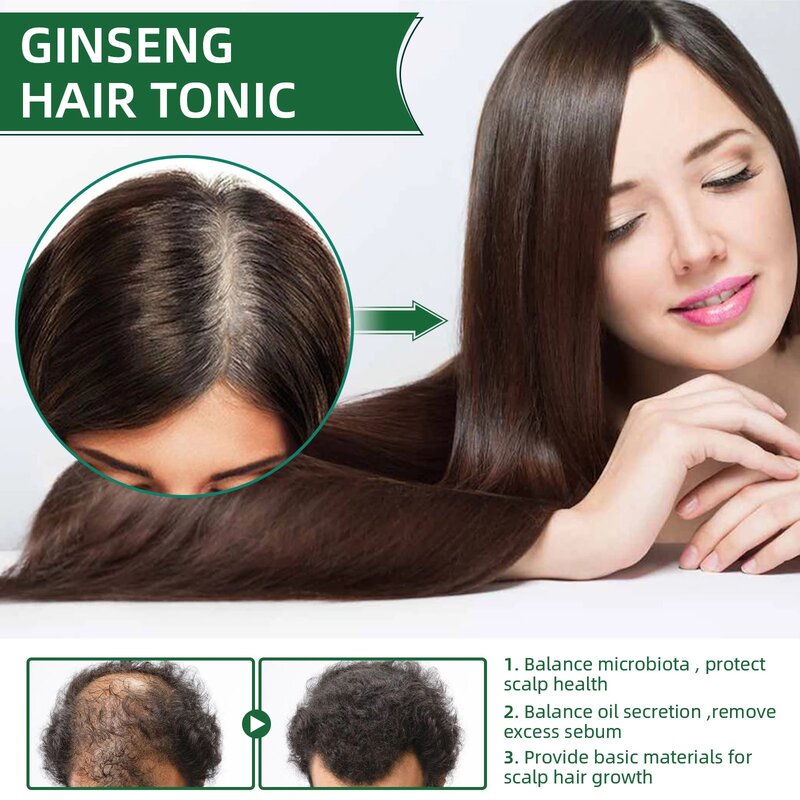 OUHOE potente olio per la crescita dei capelli previene la caduta dei capelli prodotti Essence Neo Genuine Ginseng Extract Spray per la crescita dei capelli Anti-caduta