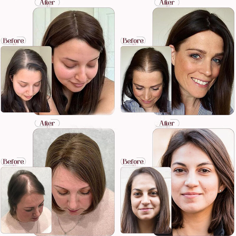 Natürlicher Haaransatz Haut basis Echthaar Topper mit 4 Clips in seidig geraden jungfräulichen europäischen Haar Toupet für Frauen