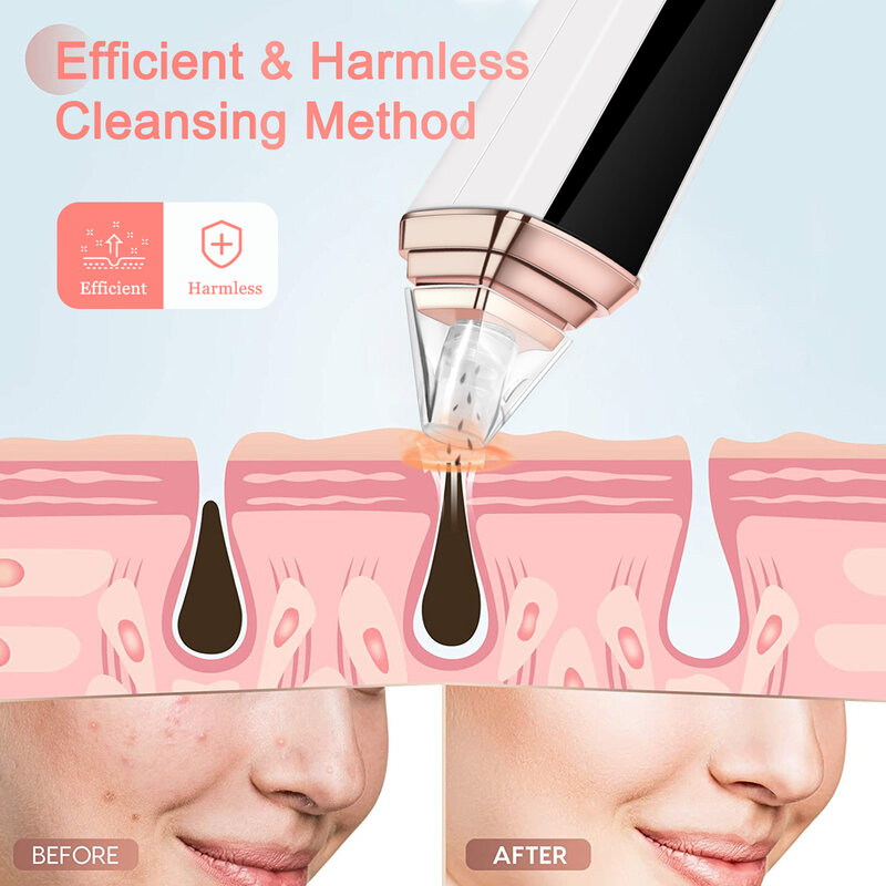 Rechargeable Display Blackhead Pore Cleaner Adjustable Modes Blackhead Pore Cleaner for Cordless and Safe Using Experience